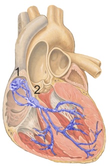 Файл:Cardiac pacemaker.jpg